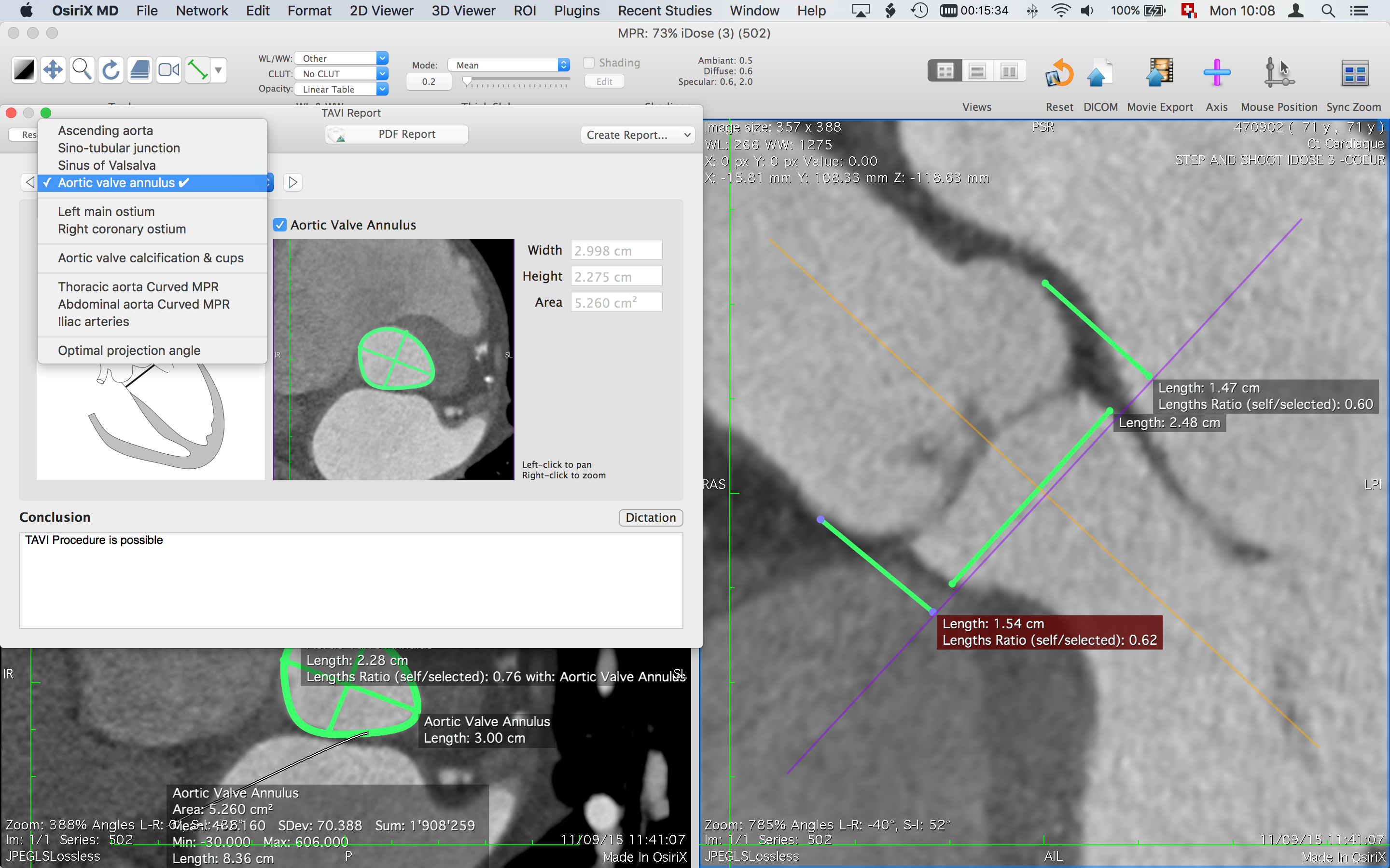 osirix dicom server