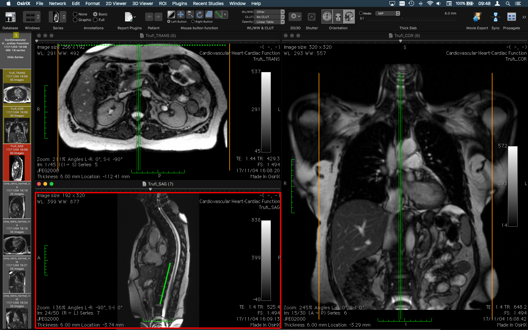 Viewer Dicom For Mac