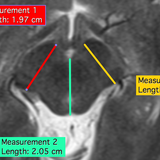 osirix lite length tool not working