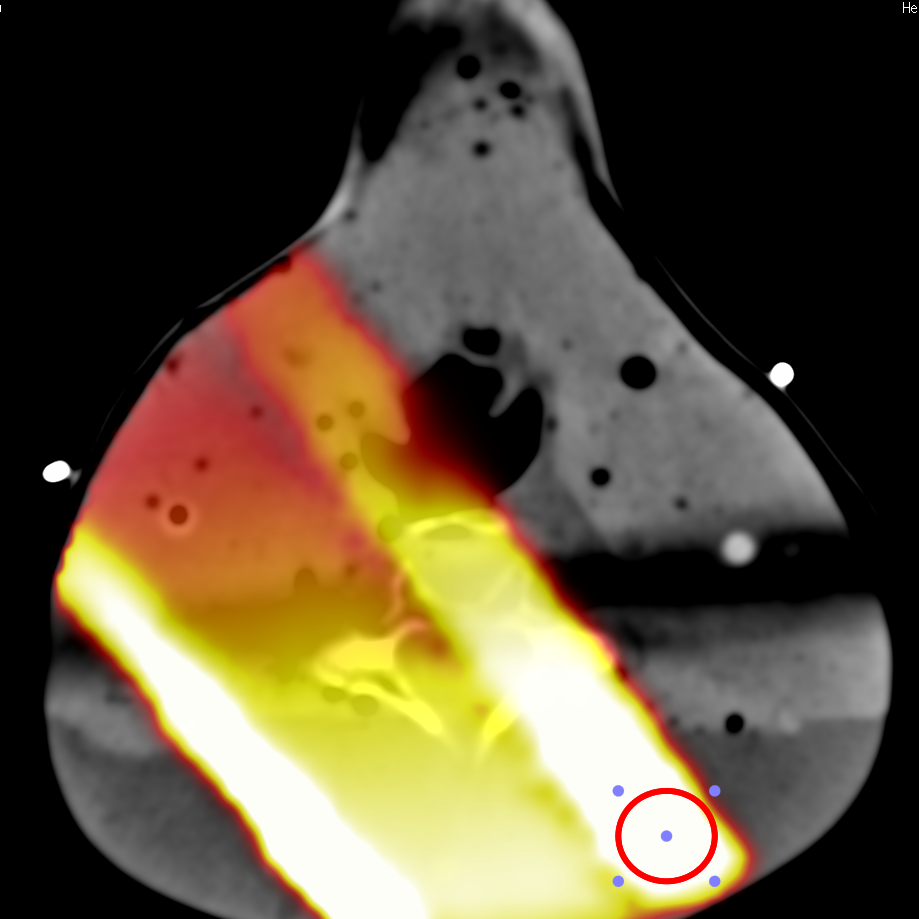 osirix dicom osirix dicom