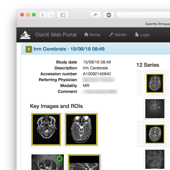 Web Portal: view ROIs and Key images