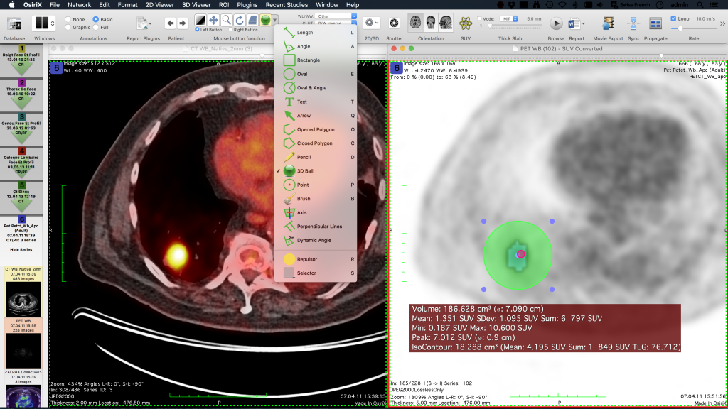 osirix lite free