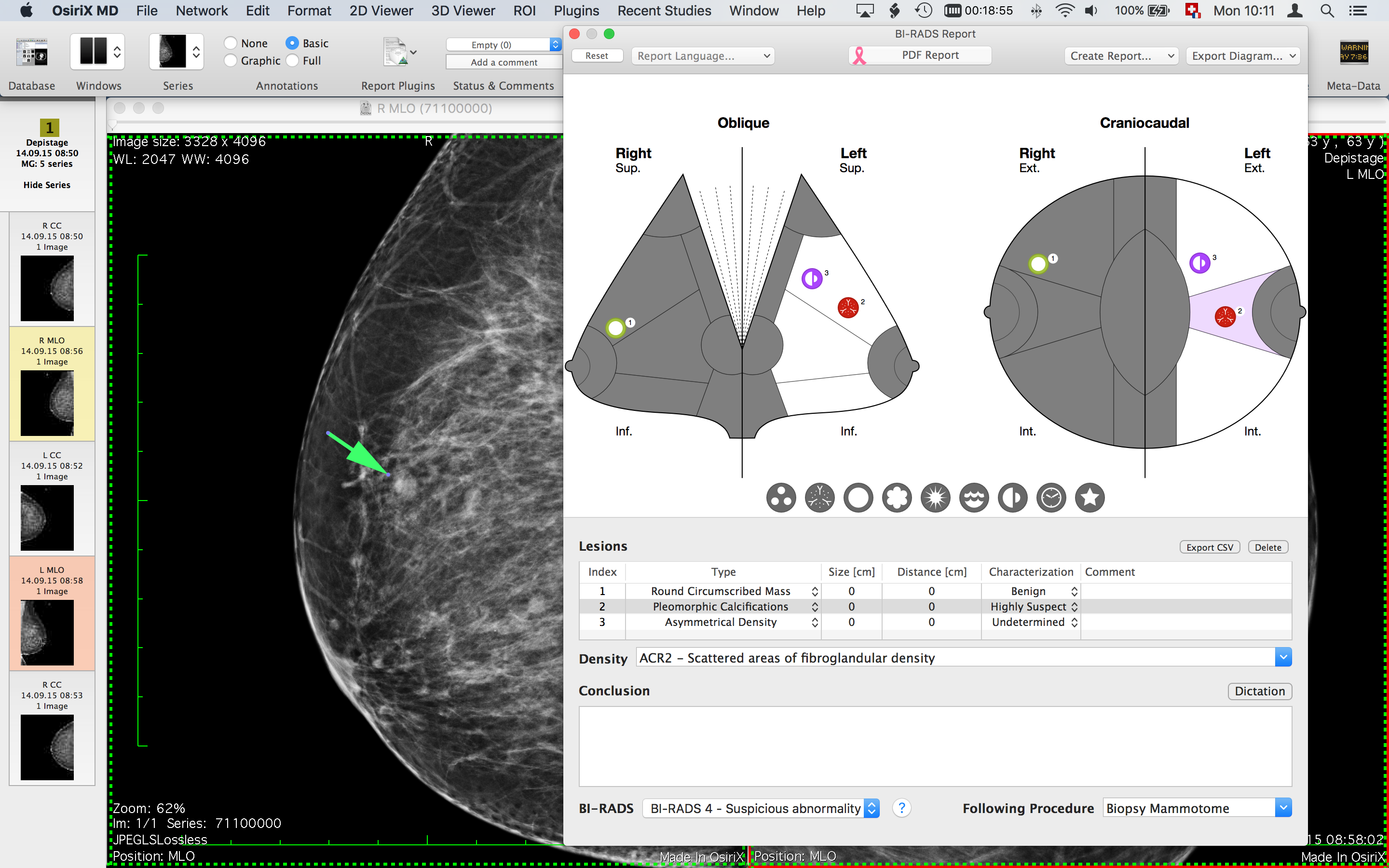 osirix md sort by te