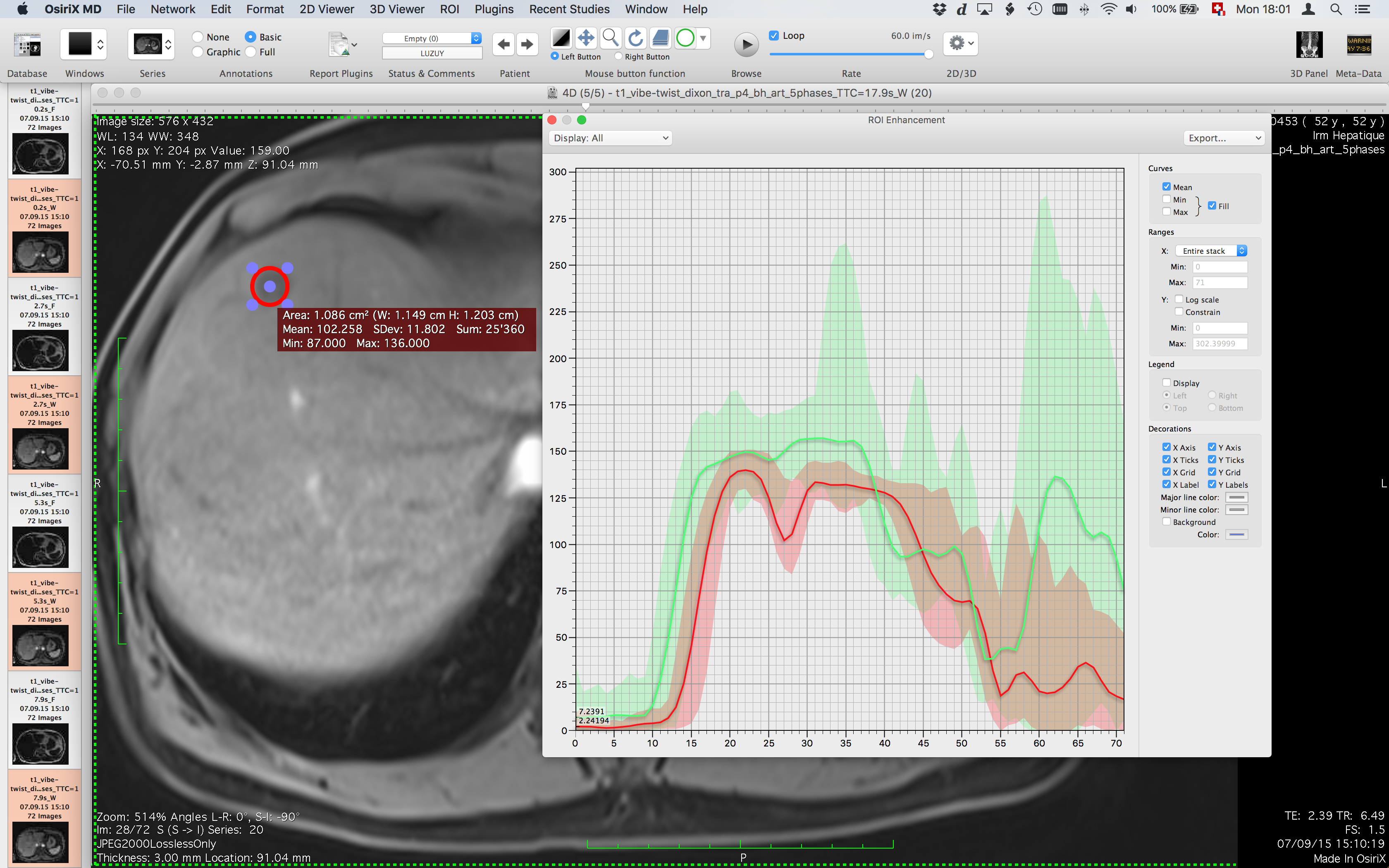 osirix lite draw roi