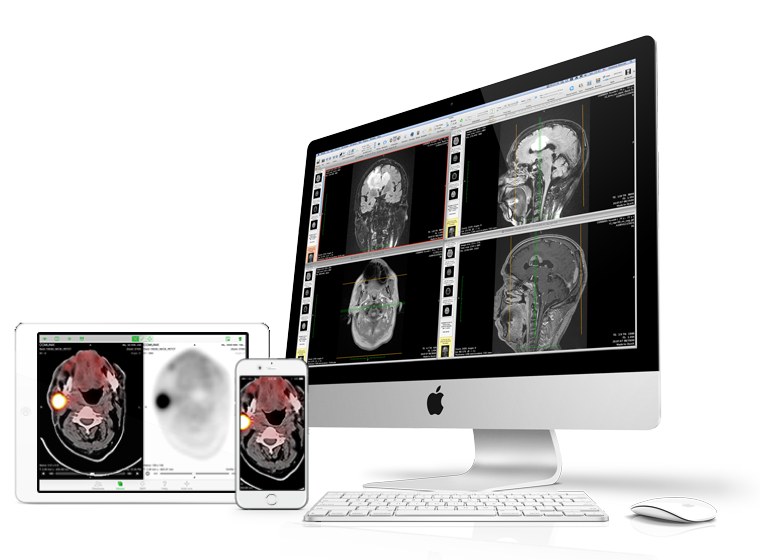 osirix dicom viewer