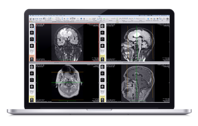 2d-viewer