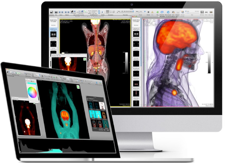 dicom image viewer for mac