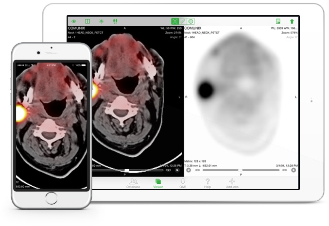 get-osirix-hd