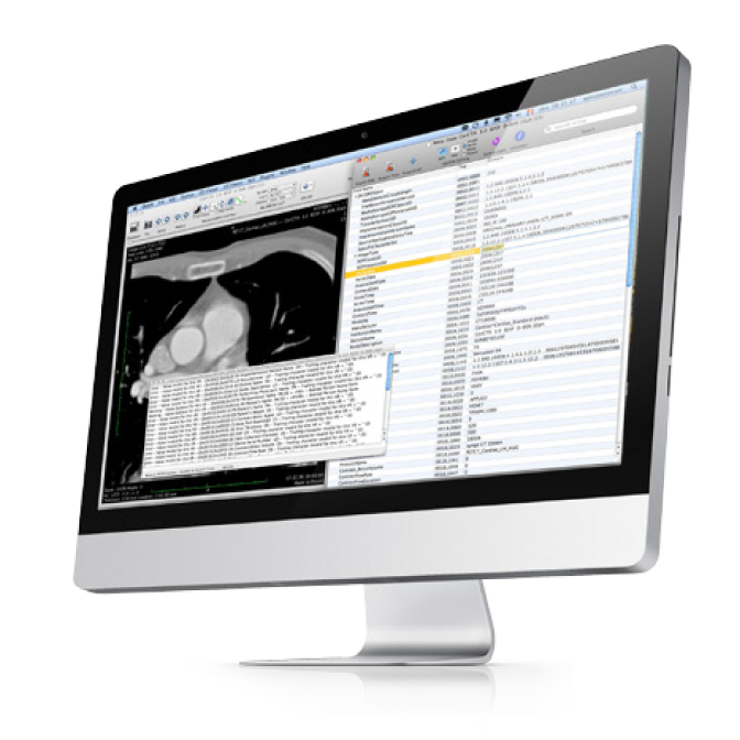 osirix dicom viewer for mac free download