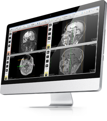 osirix dicom server