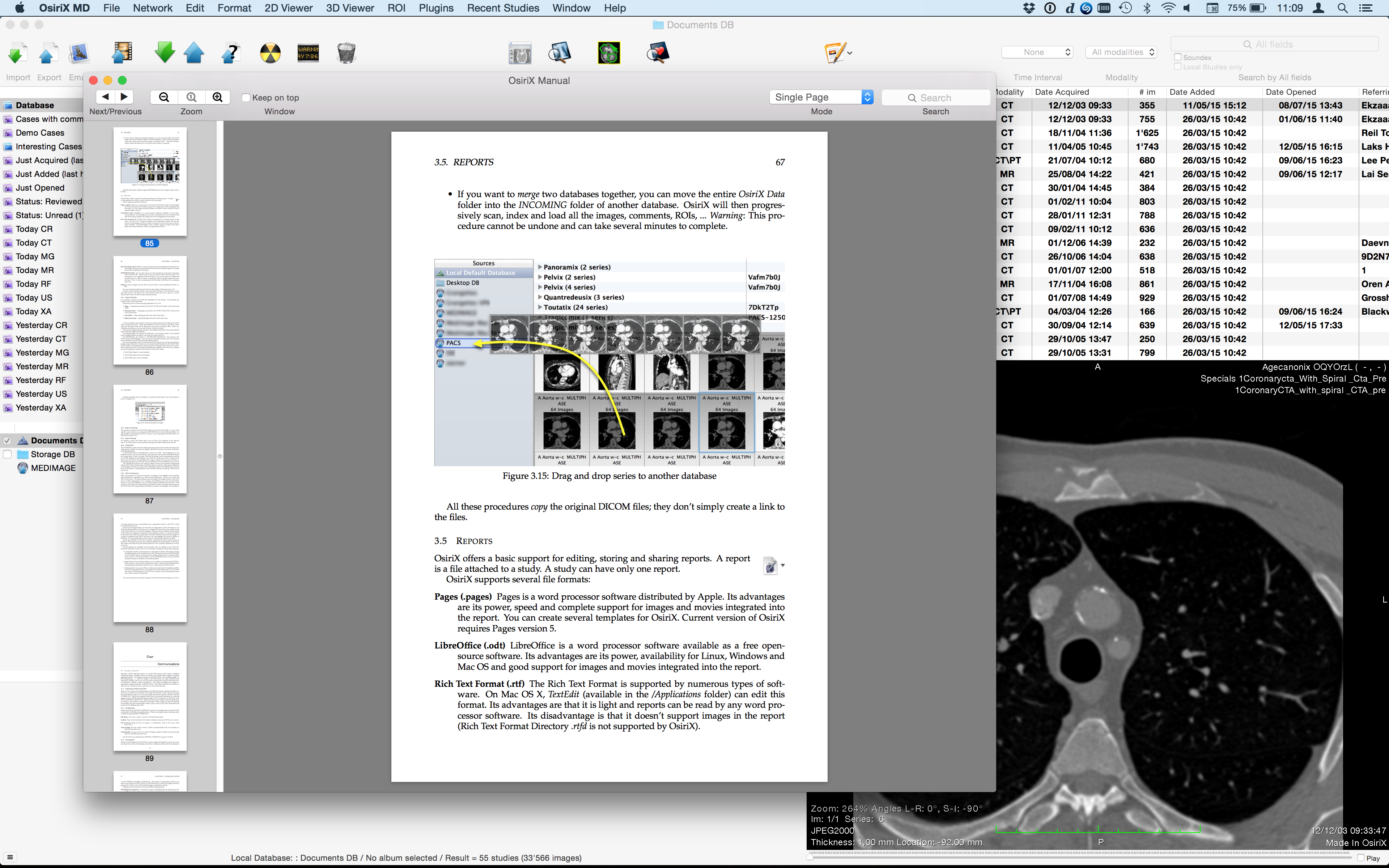 Osirix Dicom Viewer Osirix User Manual