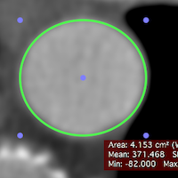 osirix md 8.02 torrent