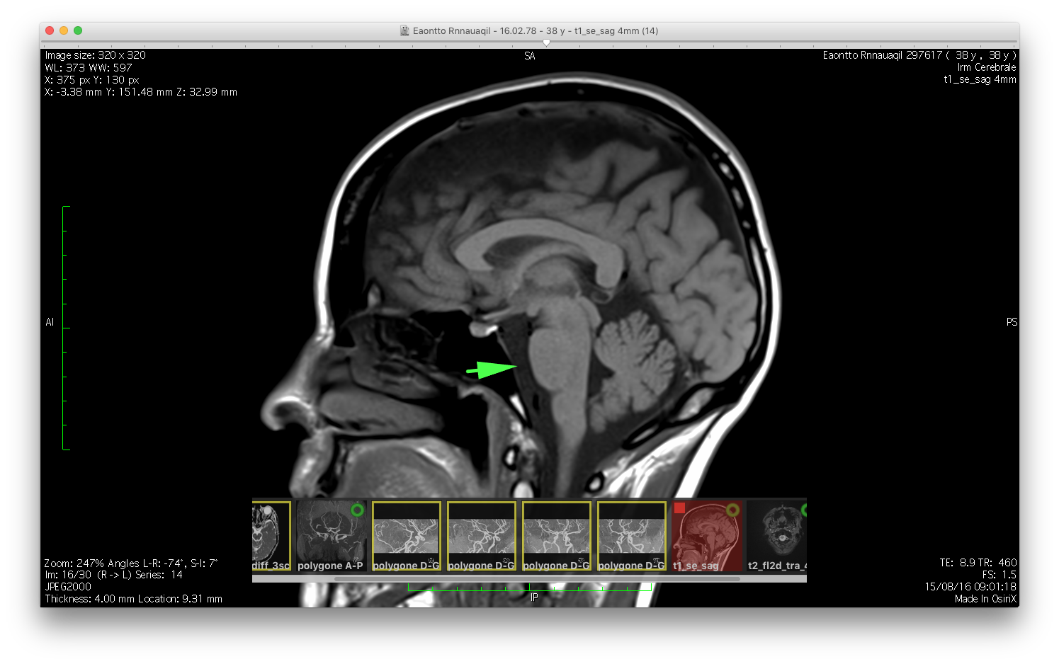 Dicom Image Viewer 10.10.5