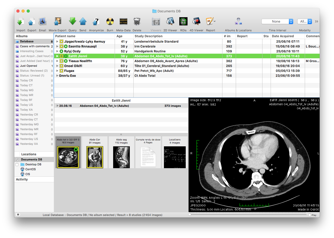 osirix md version too many devices