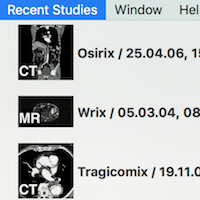 Thumbnails in Recent Studies Menu