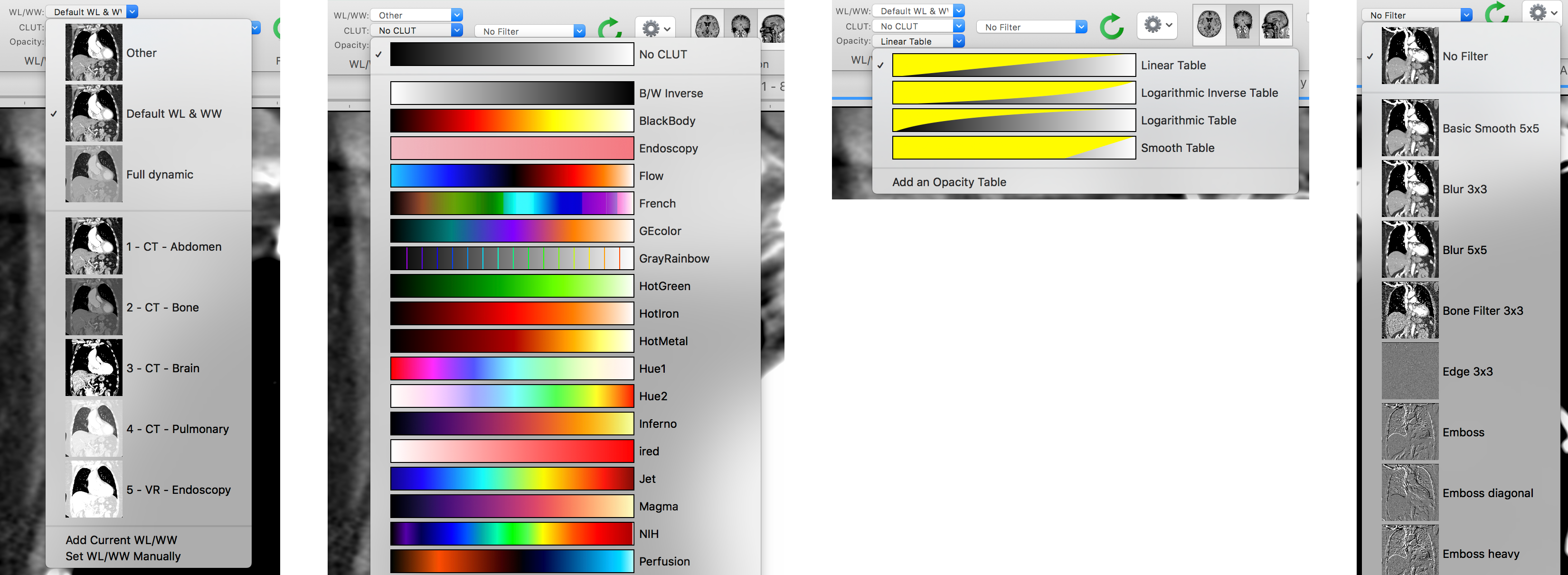 adding a clut to osirix md