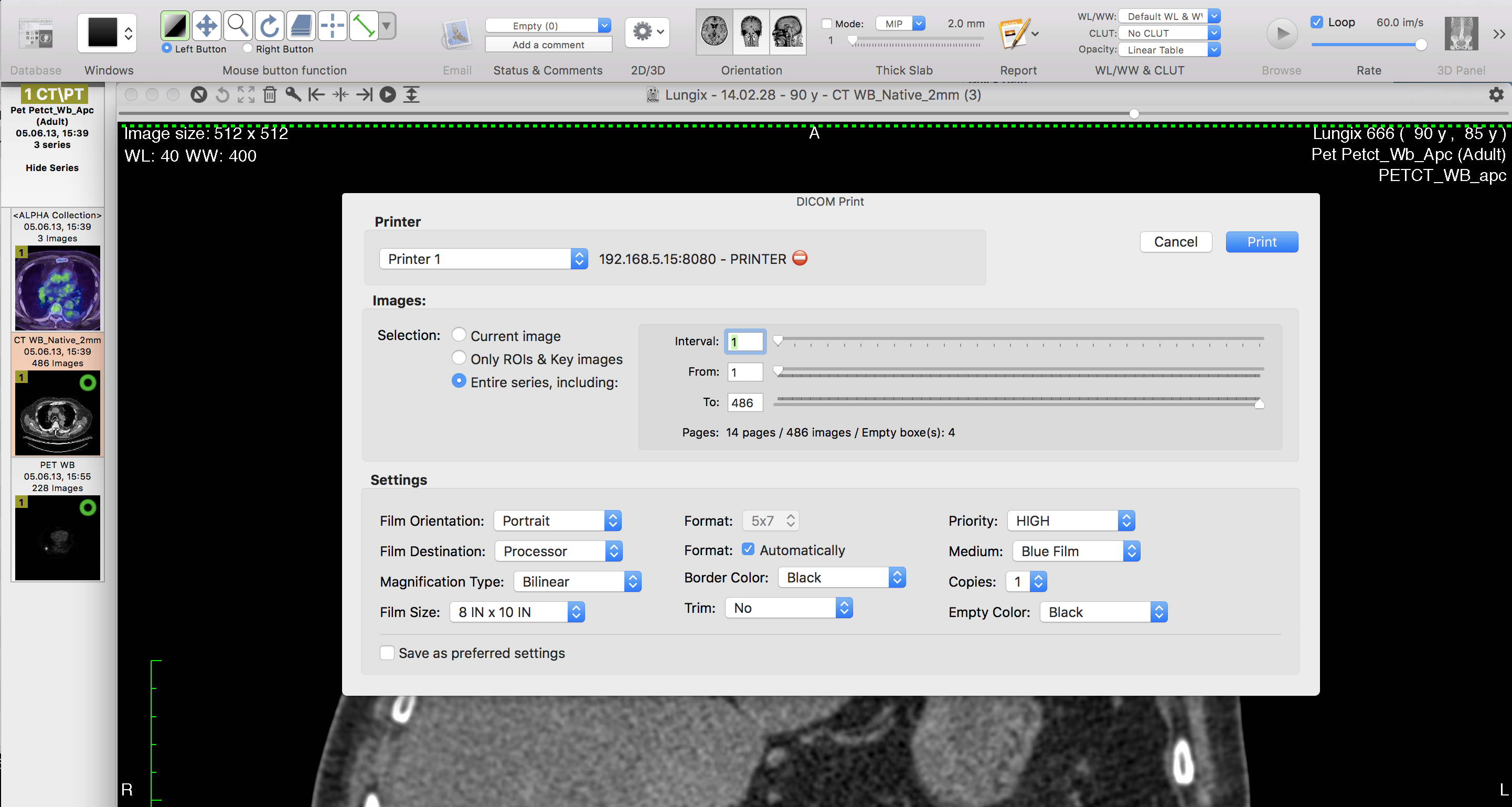 osirix md software