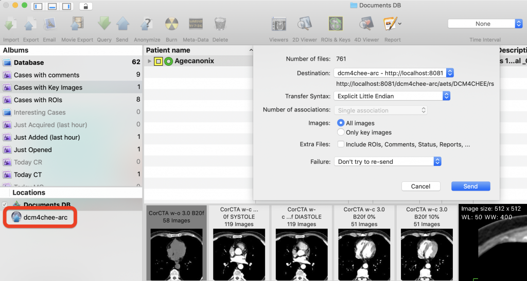 open source dicom pacs