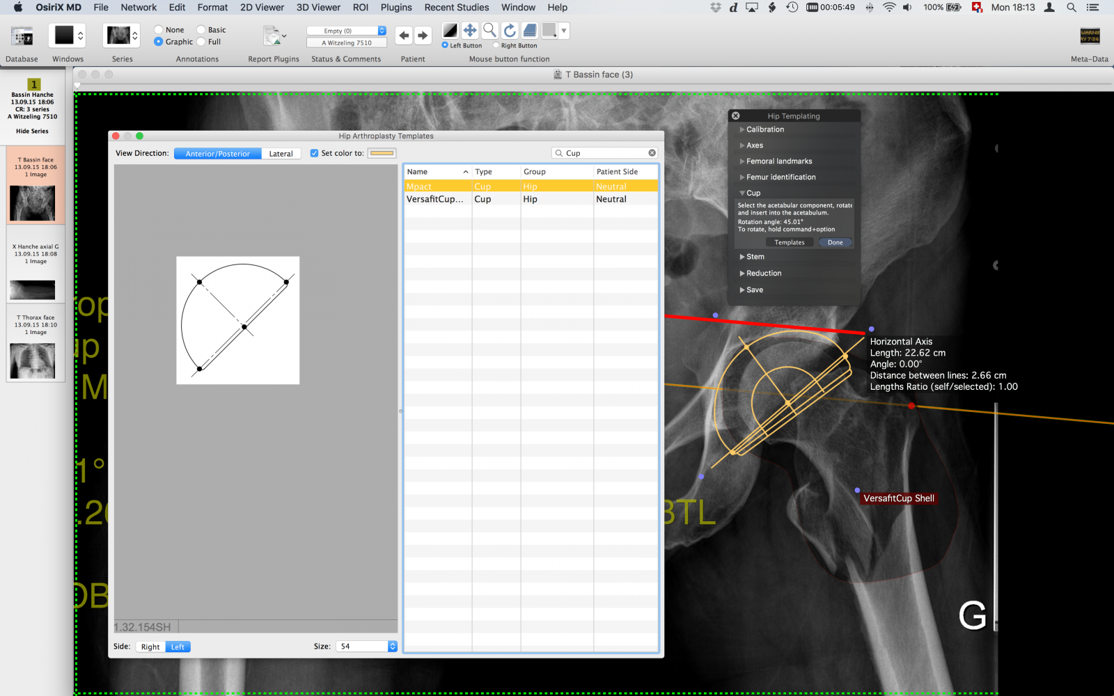 osirix dicom image library osirix dicom image library