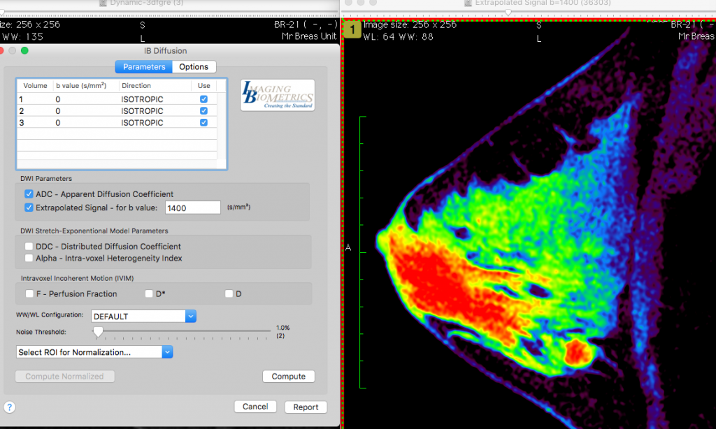 file format of an osirix dicom data set