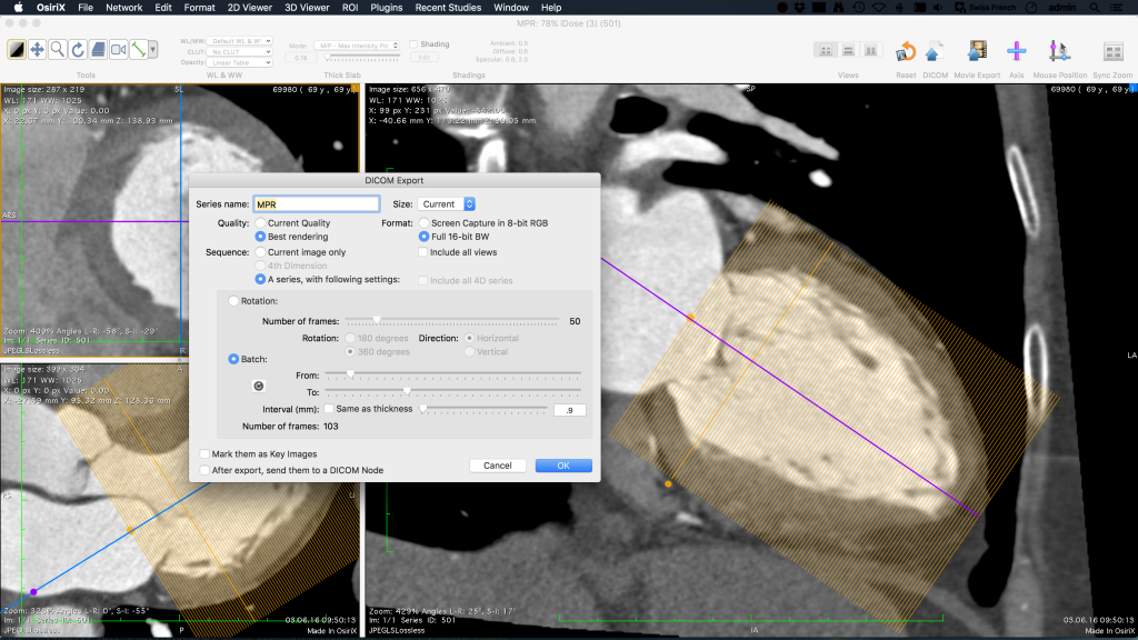 osirix md server