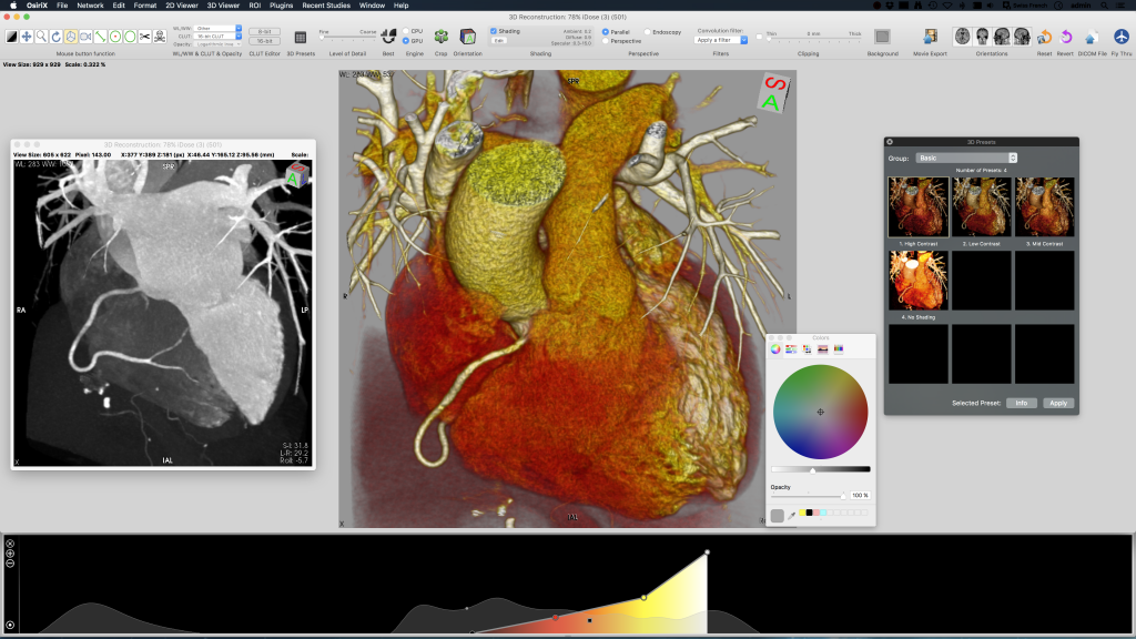 OsiriX DICOM Viewer | OsiriX MD