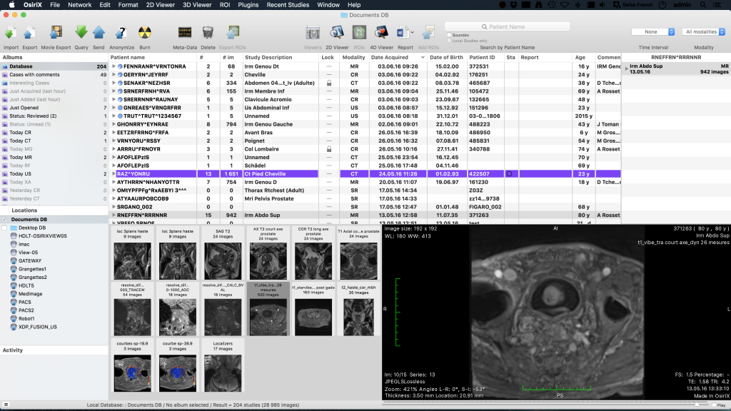 osirix md sorting osirix md sorting