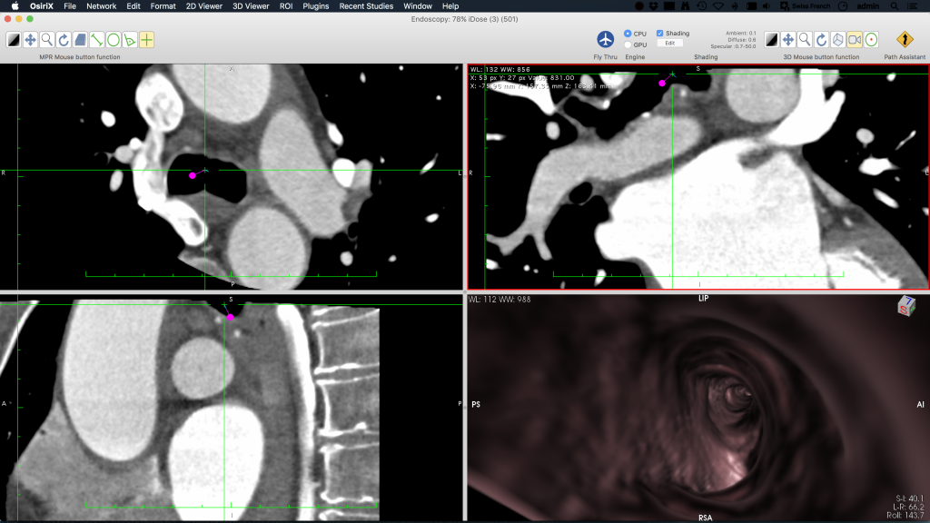 osirix md free