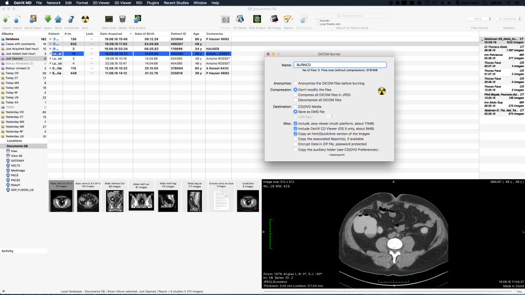 osirix dicom download