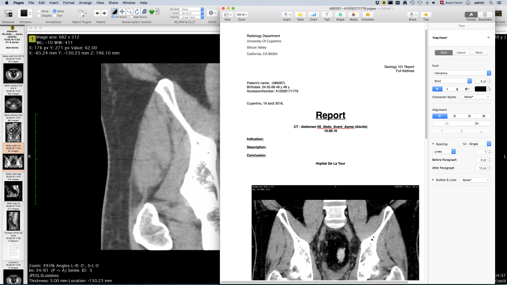 Osirix Md For Mac