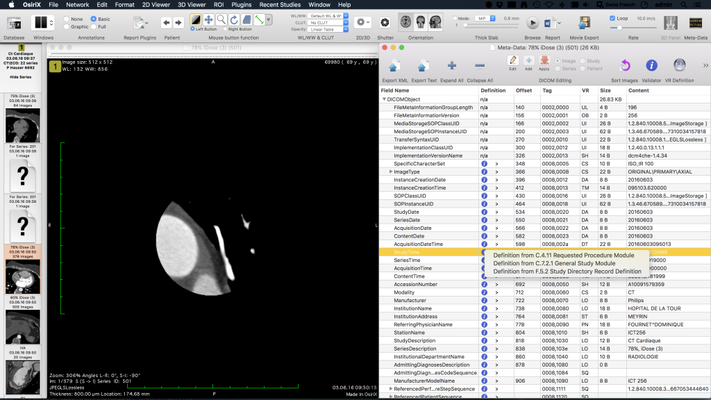 osirix md free