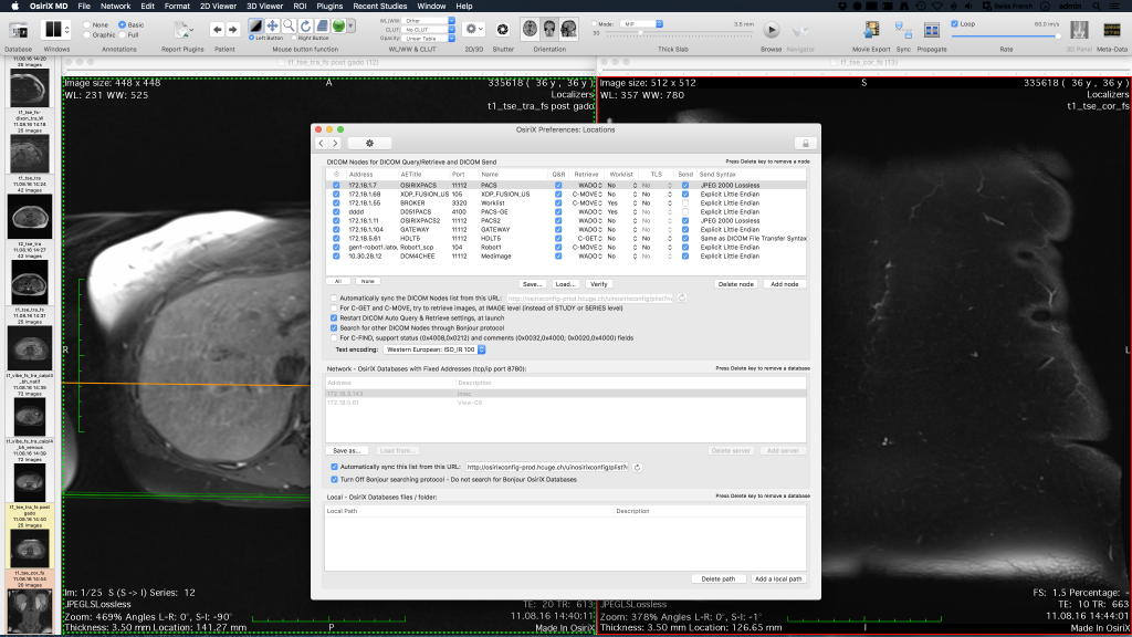 osirix dicom server