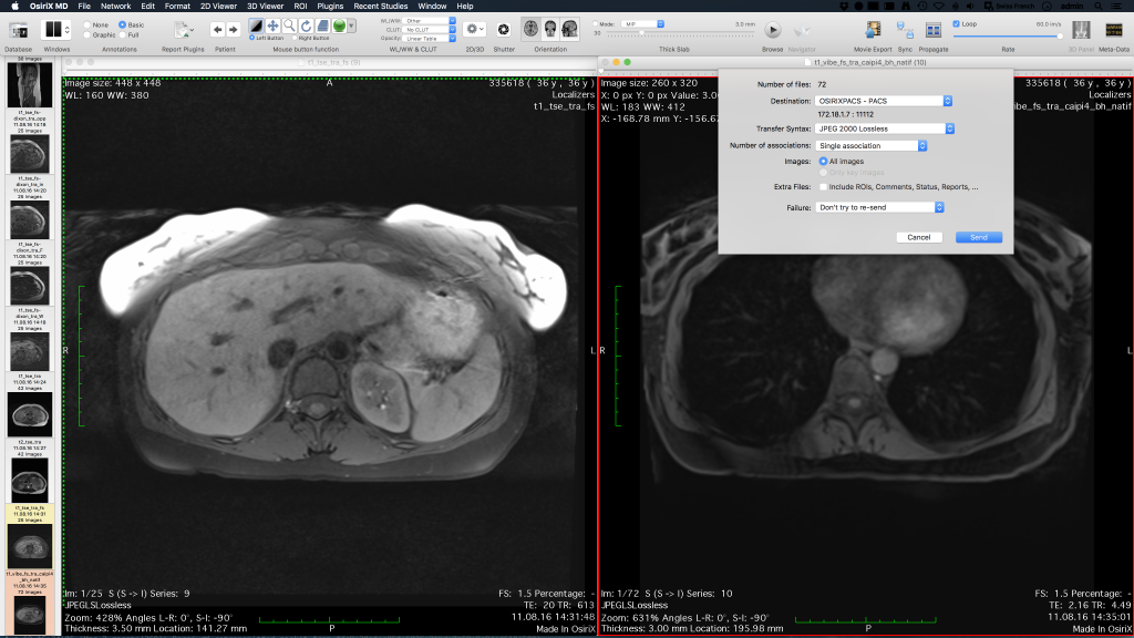 osirix italiano