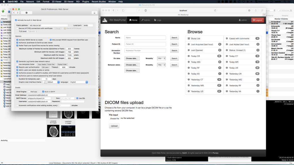 osirix lite windows