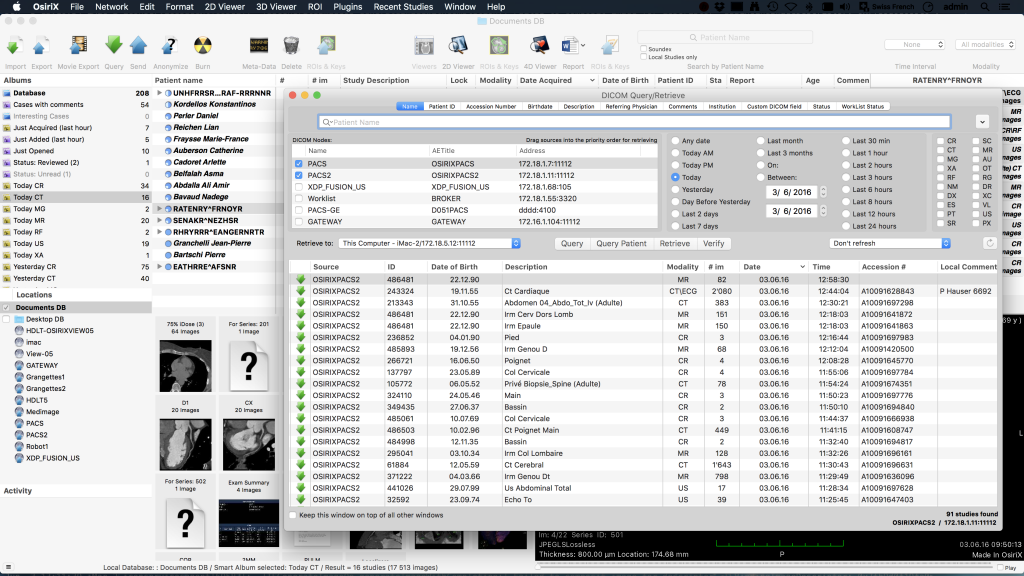 osirix lite length tool not working