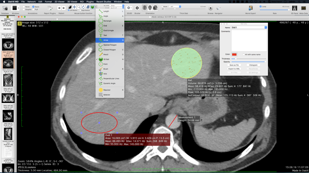 Osirix Dicom Viewer Osirix Md