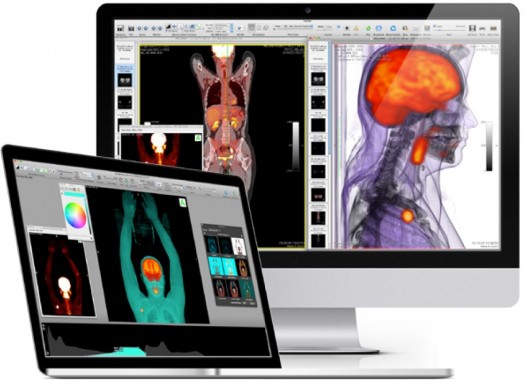 OsiriX DICOM Viewer | OsiriX MD