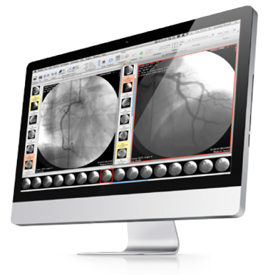 osirix lite length tool not working osirix lite length tool not working