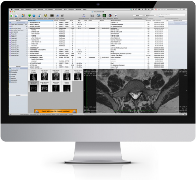 OsiriX DICOM Viewer | OsiriX MD