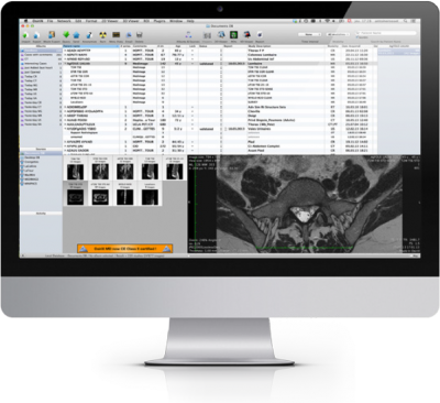 features osirix md