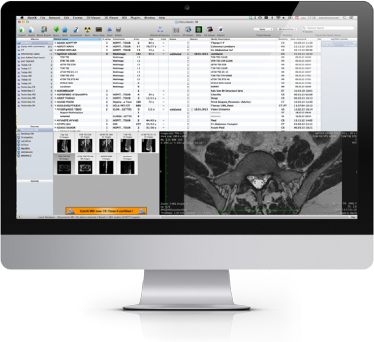 dicom osirix windows