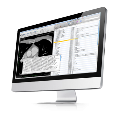 features osirix md