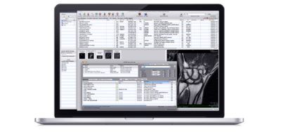 osirix lite mac store