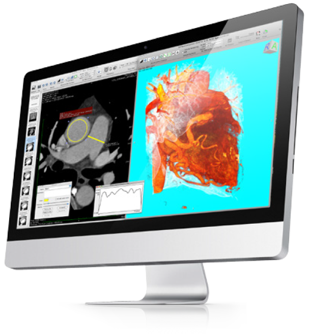 osirix md free download for mac osirix md free download for mac