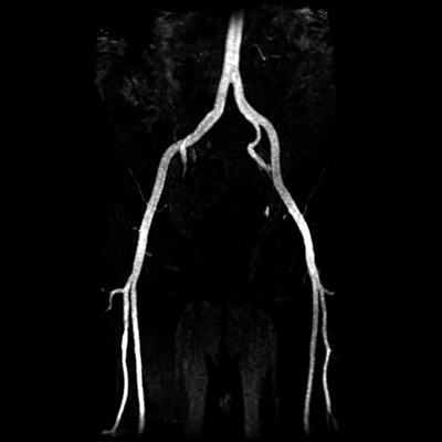 osirix dicom library osirix dicom library
