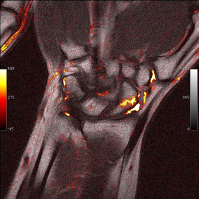 url to launch osirix viewer