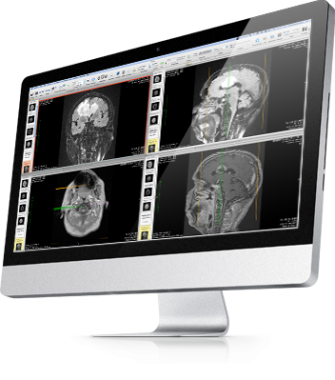 osirix md free download for mac