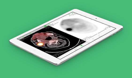 OsiriX DICOM Viewer | Overview