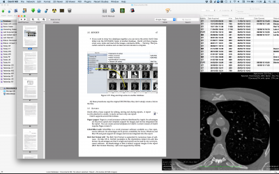 osirix lite nifti to dicom osirix lite nifti to dicom