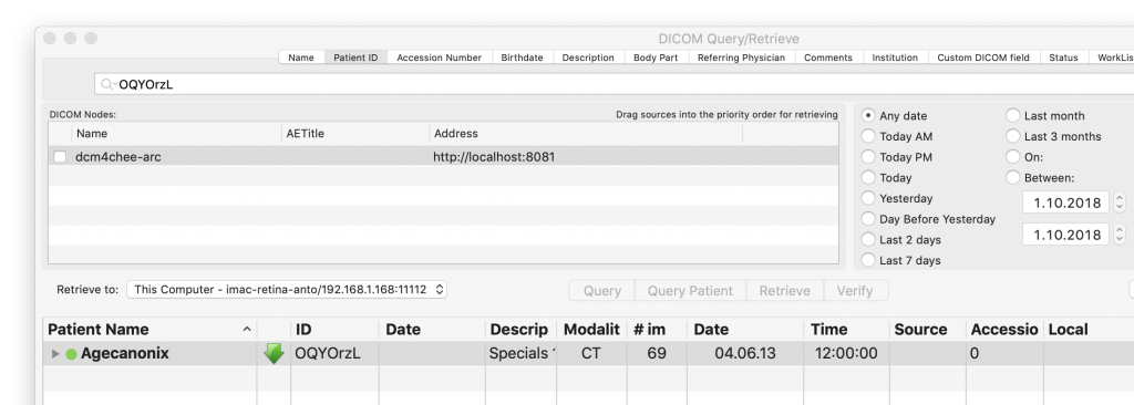 Query the PACS from OsiriX MD